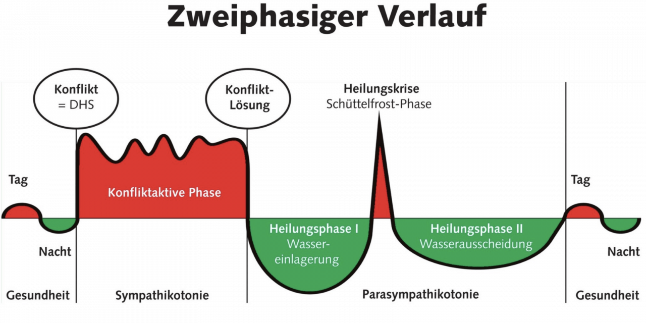 Kritische Gedanken zur Neuen Medizin von Ivan Koval